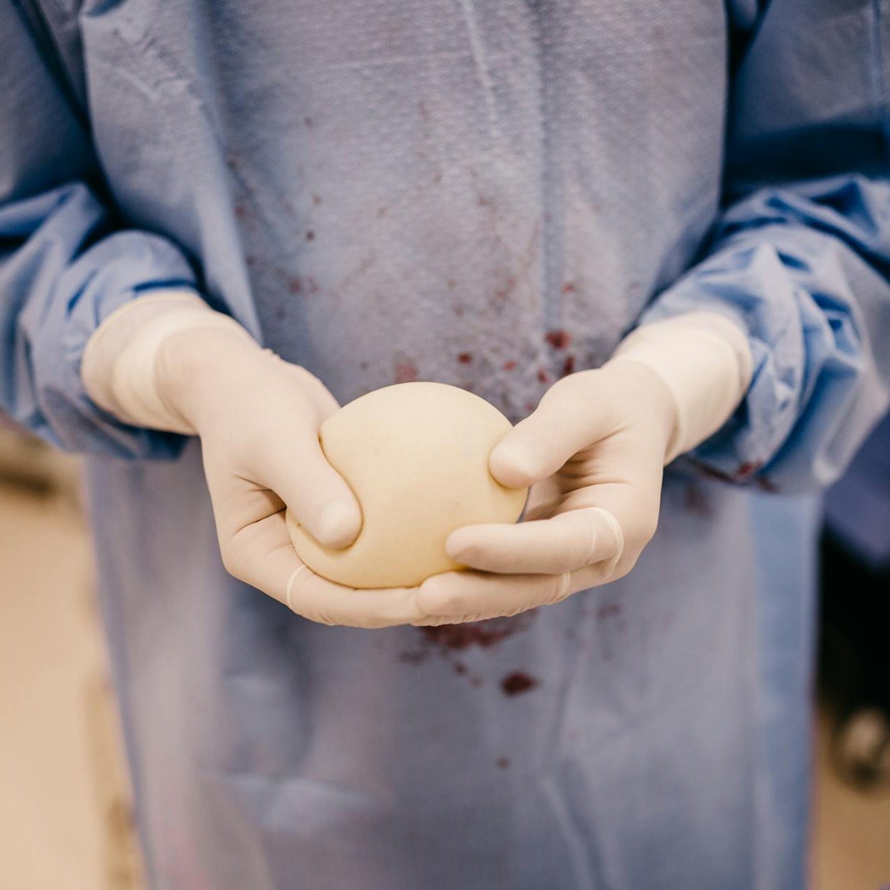 Breast implant removal Gold Coast, Explant surgery Australia, En bloc capsulectomy specialist, Breast implant illness removal, Breast lift after implant removal