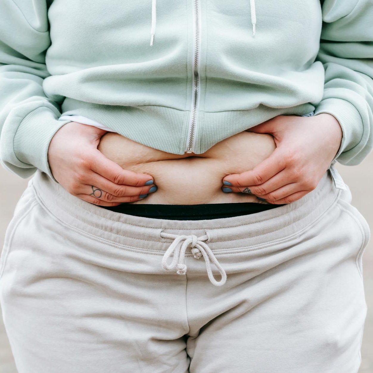 Abdominoplasty: What You Need to Know Before the so-called “Tummy Tuck” Surgery